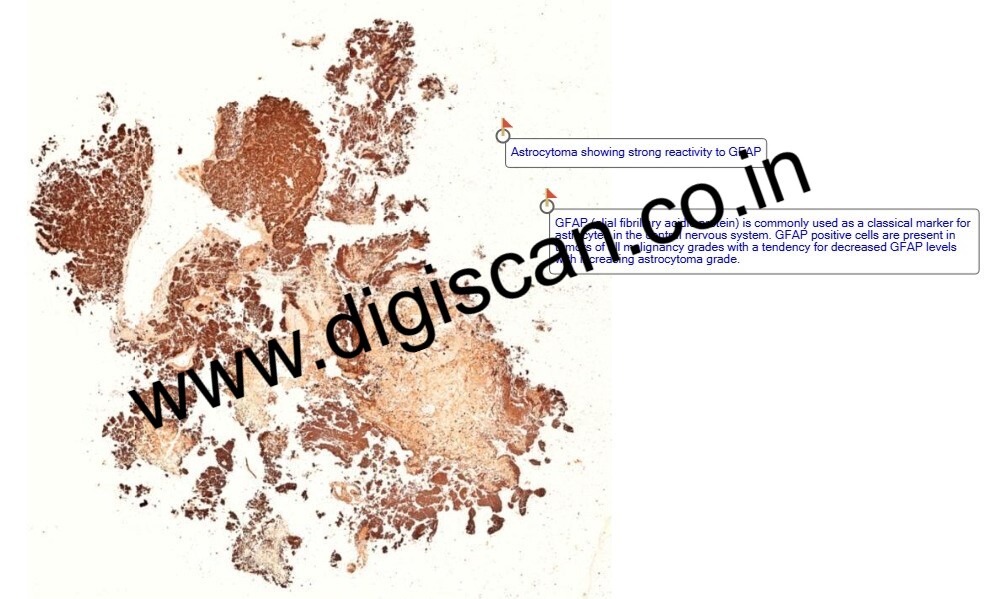 Immunohistochemistry Digital Slides Set (IHC Markers & Cases)